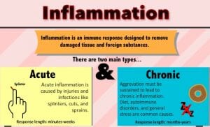 Natural inflammation treatments