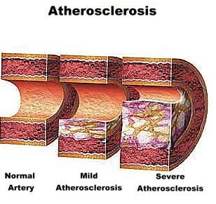 Nitric Oxide health benefits you should know about