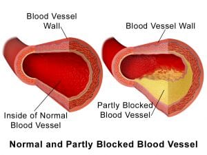 Natural heart health supplements