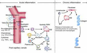 Natural inflammation treatments