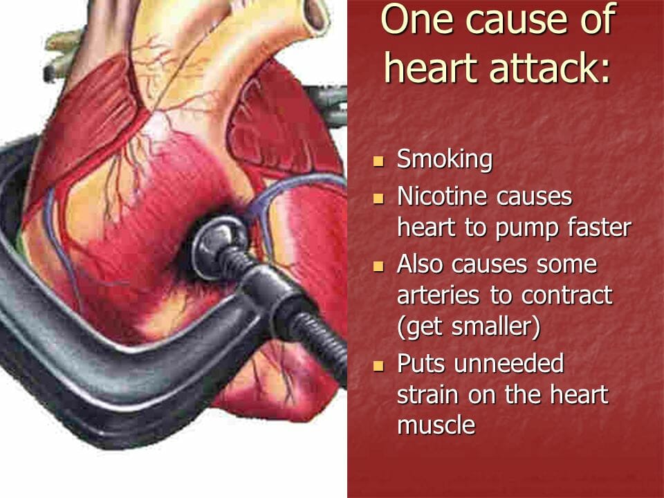 Can vitamin K2 reverse arterial calcification?