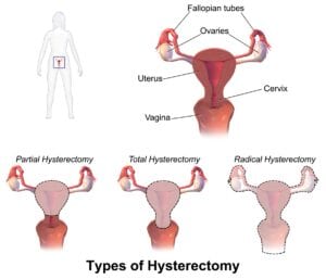 Is Serrapeptase the best endometriosis natural treatment?