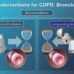 Best treatments for COPD