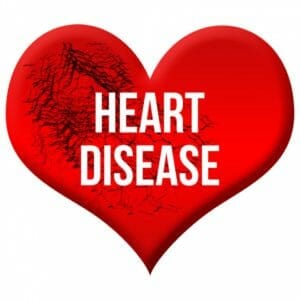 Heart disease image