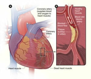 Nitric Oxide health benefits you should know about