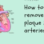 How to remove plaque in arteries